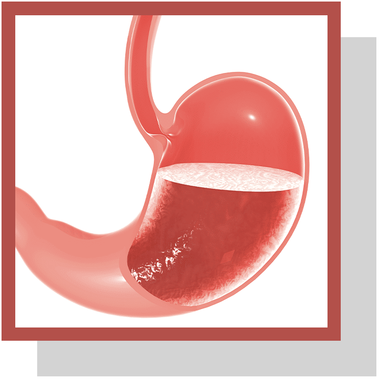 Quel Ion Est Responsable De L'acidité Du Suc Gastrique